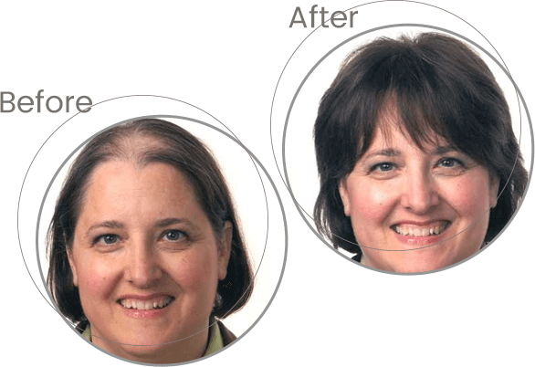 executive hair additions